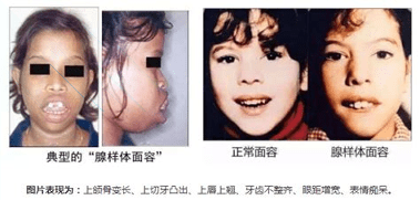 益医生安卓应用下载